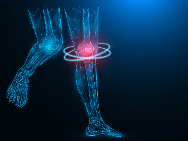 An animated illustration of knee bone pain model 