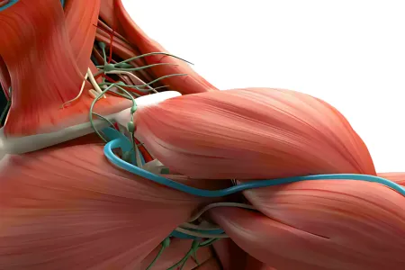TOS syndrome