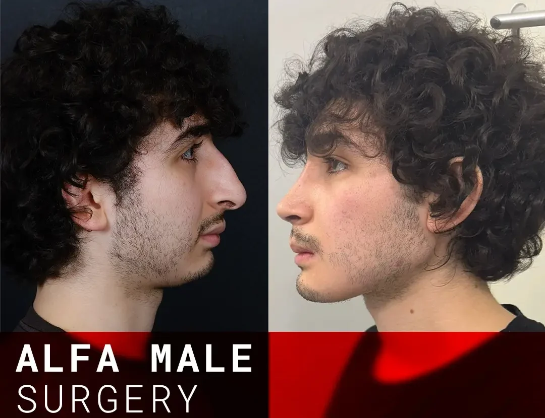 alpha male before after opposite