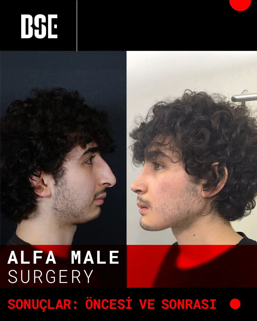 alpha male before after opposite
