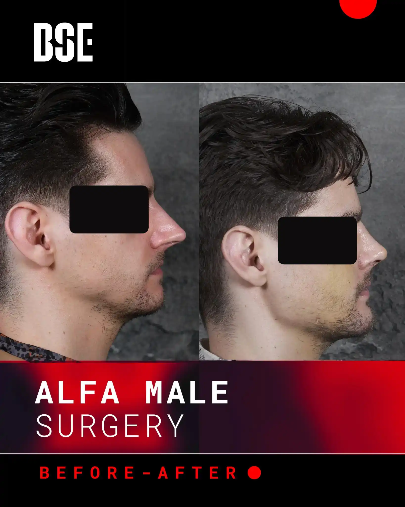 alpha male before after profile